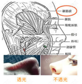 宁波壹加壹林勇筋膜包裹隆鼻技术