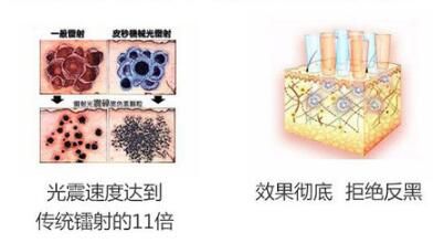 彭医生讲超皮秒祛斑的原理图