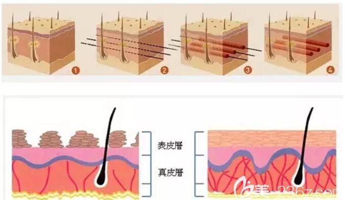 胡慧敏医生分享面部 4D 精雕术