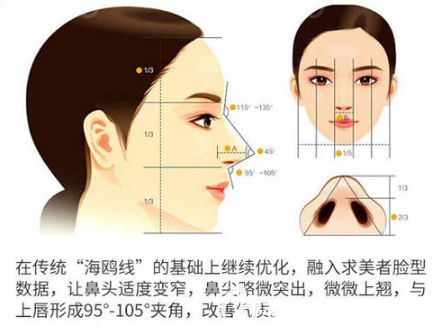 佛山苏李秀英杨智伟隆鼻特点