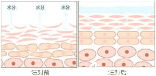 上海韩镜医疗美容医院宗建华注射功效