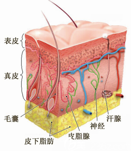 王晓军医生教你正确认识瘢痕疙瘩