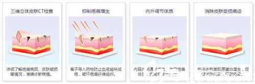 离子靶向多维祛疤体系修复疤痕原理