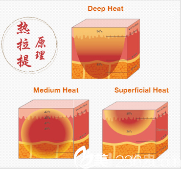 热拉提原理示意图