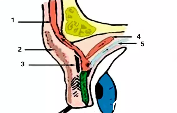 上睑下垂矫正CFS手术